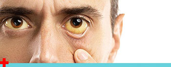 Eye Infections Treatment Doctor Near Me in Kingwood, TX