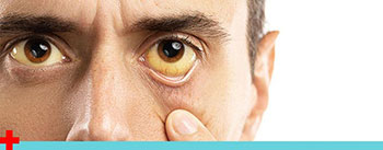 Eye Infections Treatment Near Me in Kingwood, TX