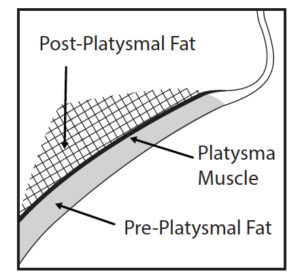 Sagittal View of Platysma Area