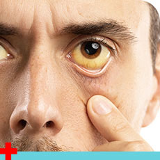 Eye Infections - Urgent Care and Walk-In Clinic Kingwood, TX